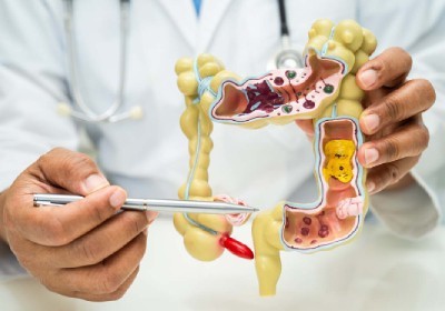 آمادگی قبل از کولونوسکوپی؛ همه نکاتی که باید بدانید